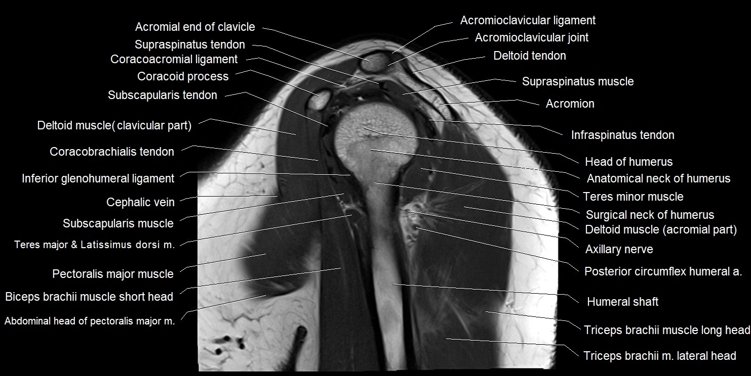 mri shoulder sagittal cross sectional anatomy image 10.webp